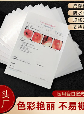 瓷白激光彩色医用打印胶片B超彩超胃镜双面打印医生医院用片A416K