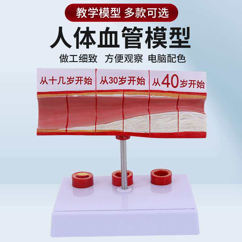 血栓模型 人体支脉粥样 硬化动脉心血管 各阶段年龄血管展示模型