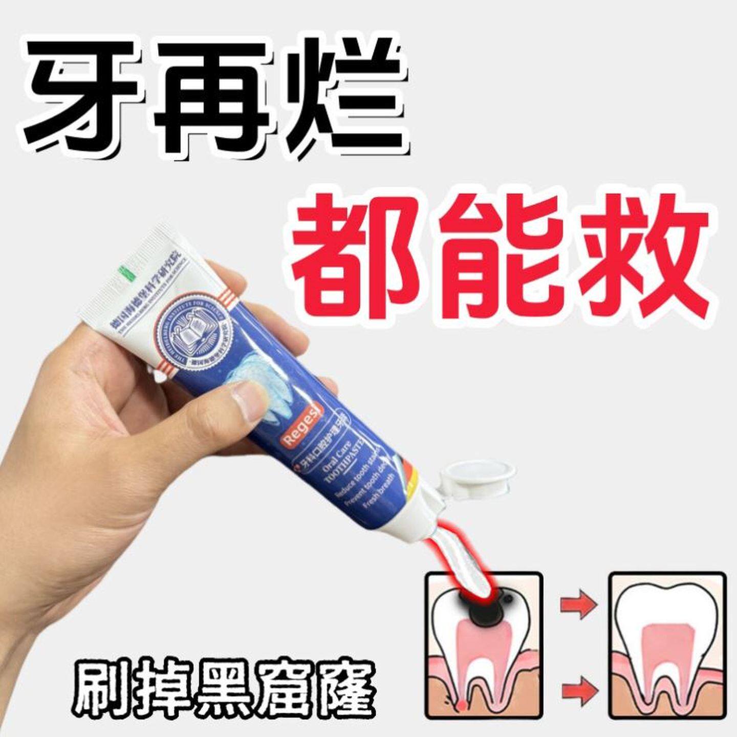 【速效救牙】德国再生硅牙膏 修护补填蛀洞牙虫 3-80岁老少通用