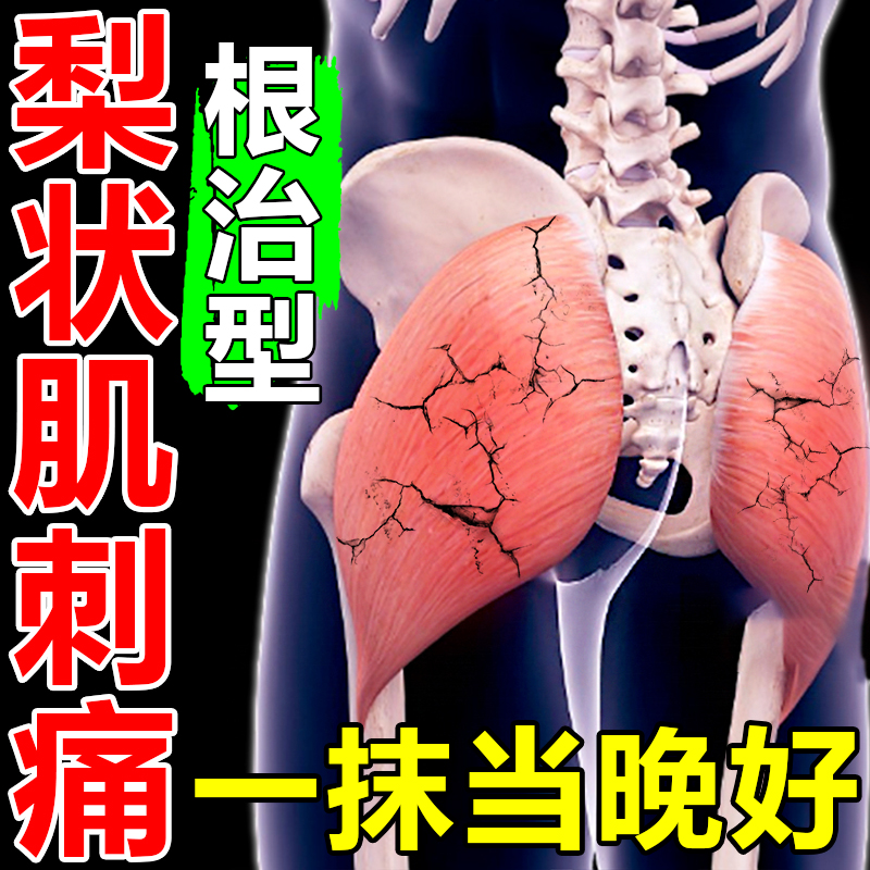 梨状肌综合症特效药【腿疼屁股痛】腰大小腿后外侧放射性疼痛麻木