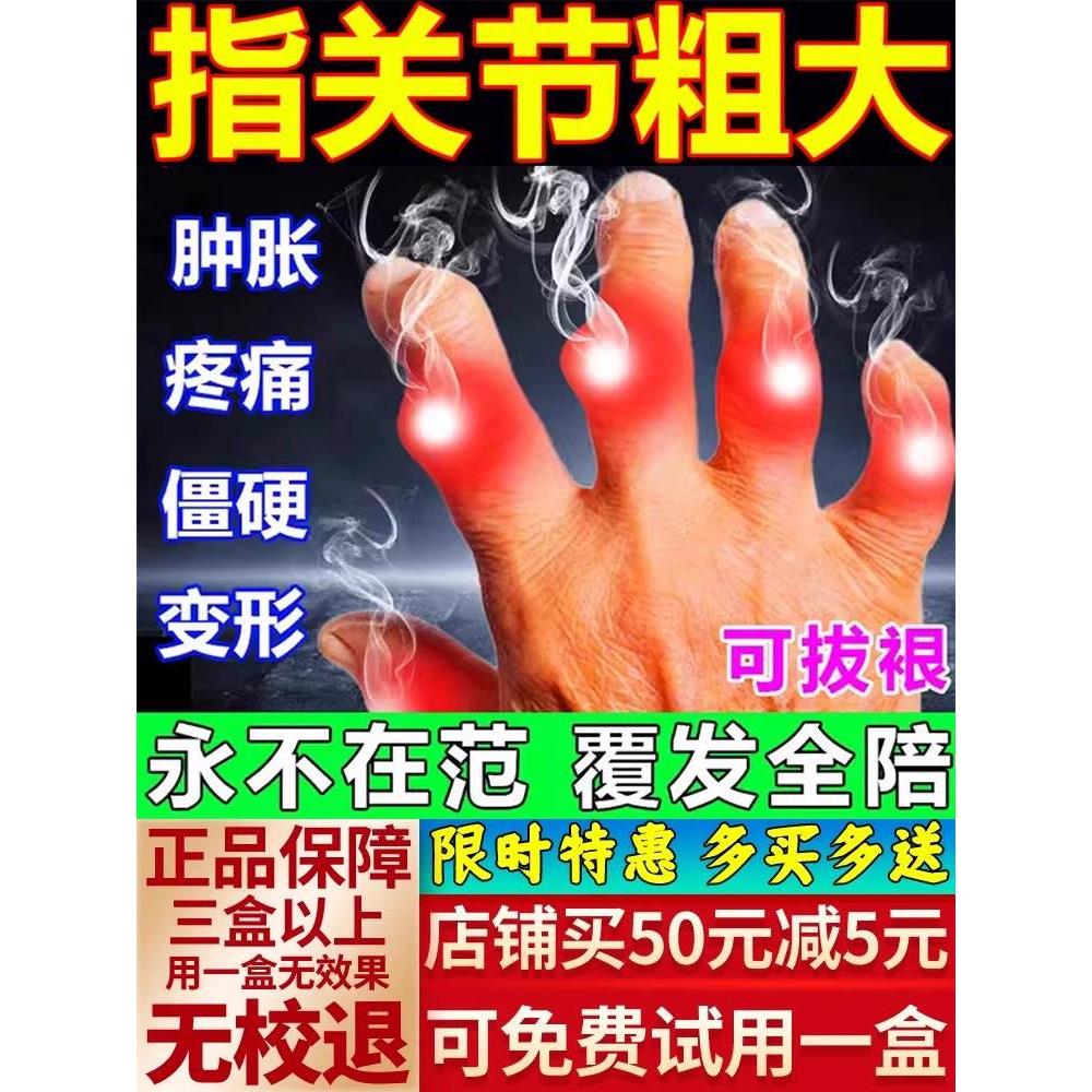 手指关节变形肿大粗大疼痛僵硬修复美手变细变长热敷神器专用药膏