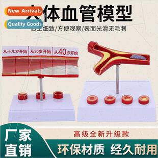 Coronary arterial cardiovascular artery model sclerosis mode