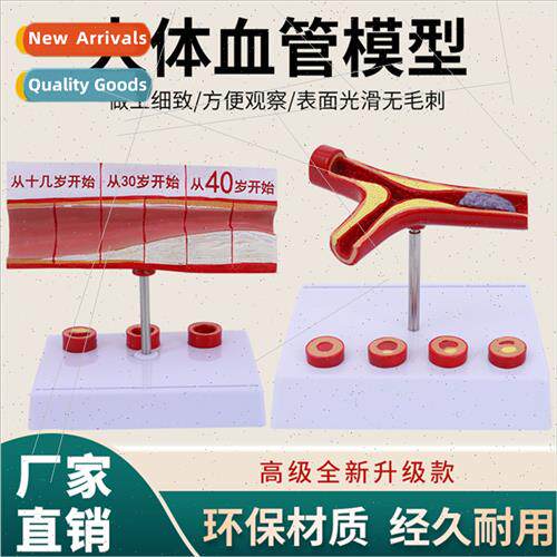 Coronary arterial cardiovascular artery model sclerosis mode