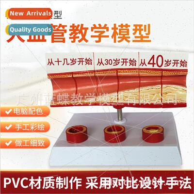 Human Vascular Anatomy Model Blood Vessel Model Artery/Harde