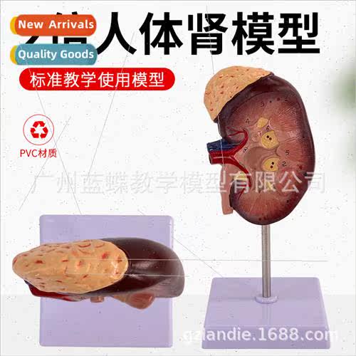 2X Enlarged Kidney Enlarged Model Enlarged Kidney Anatomy Mo