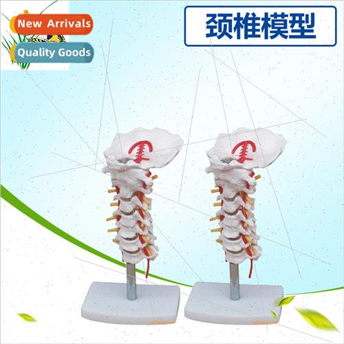 Cervical spine wh carotid artery model erior occipal bone mo