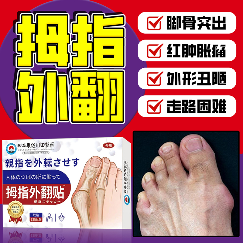 日本研发拇指外翻膏贴大脚趾药贴