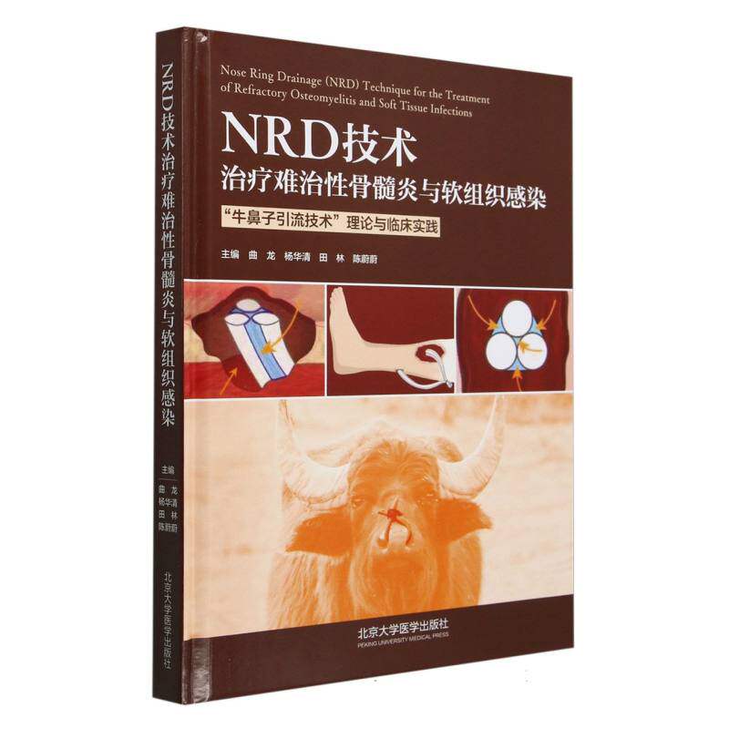 正版包邮 NRD技术治疗难治骨髓炎与软组织感染(牛鼻子引流技术理论与临床实践)(精) 编者:曲龙//杨华清//田林//陈蔚蔚|