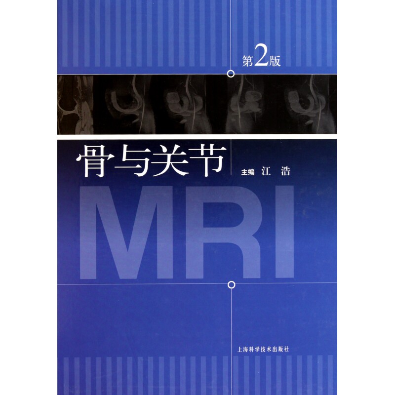 骨与关节MRI(第2版) 骨与关节MRI 第2版更新 影像解剖详解 临床诊断指南 病例解析实例 专业医学教材 医师书籍 9787547805954