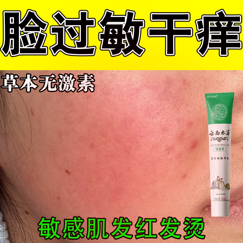 面部泛红干痒刺痛起皮肌肤敏感发红植物萃取舒缓修护膏