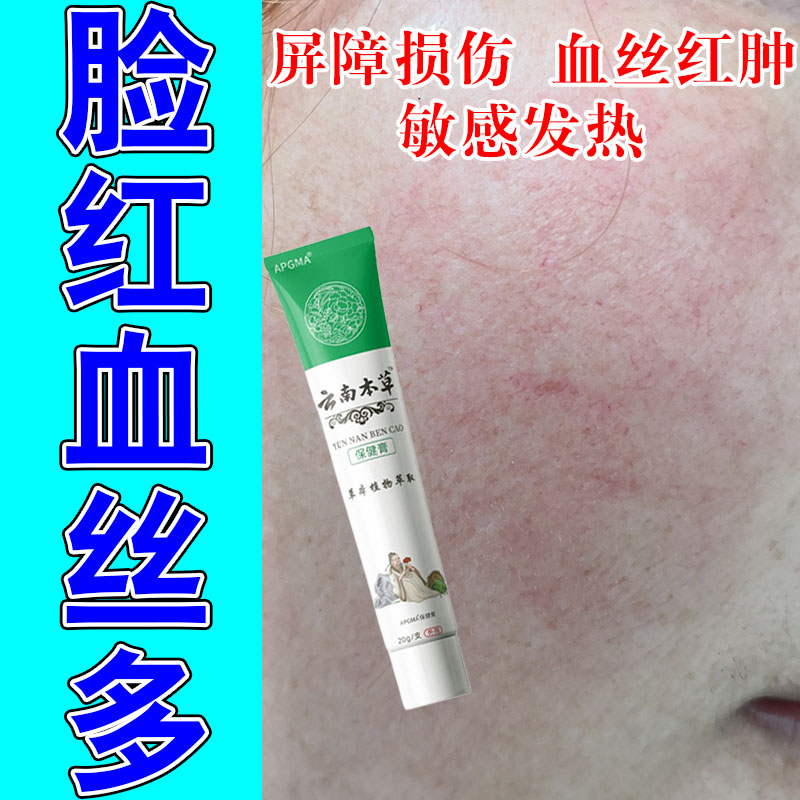 脸上泛红长红血丝过敏脸部敏感皮肤泛红长红血丝专用草本乳膏