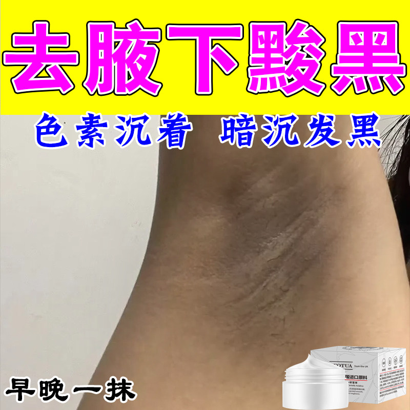 胳肢窝发黑腋窝肌肤暗沉腋下褶皱粗糙腋下角质堆积发黑暗沉修护膏