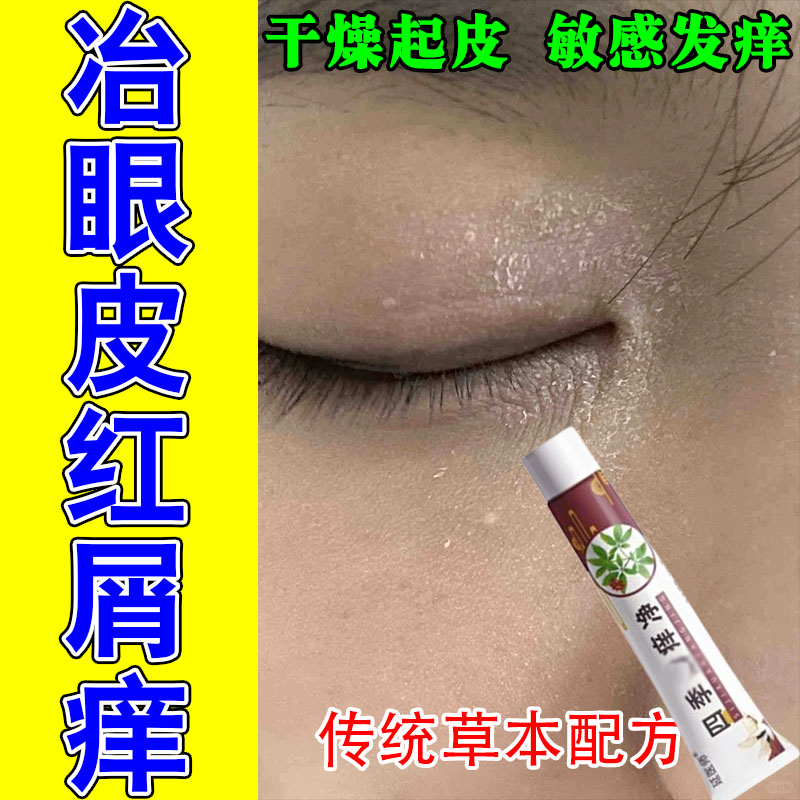 眼皮神经性过敏眼皮红肿痒眼周泛红发痒眼角干燥起皮屑修护植物膏