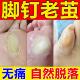 脚钉祛除膏去除厚脚垫老茧死皮根去脚底板脚掌趾指头硬皮软化剂药
