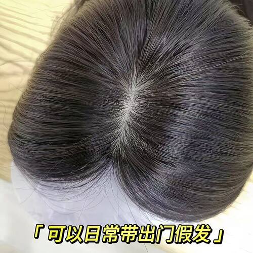 真发递针蓬松高颅顶隐形无痕补发