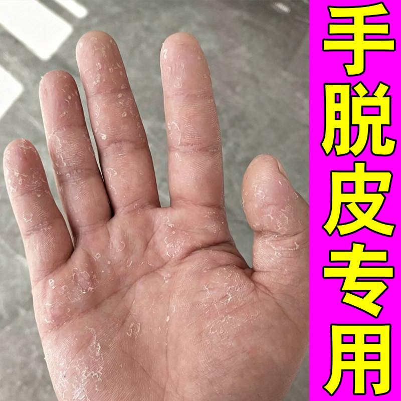 手干裂修复膏防干裂脱皮季节性手足裂疼痛专用修复软膏