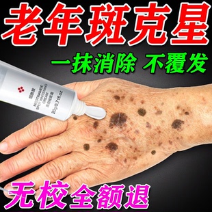 手上老年斑强力去除手部祛斑手背晒黑斑黄褐斑黑色素沉淀淡斑美白