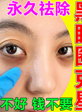 黑眼圈药膏消除黑色素沉淀治眼皮跳痉挛熬夜祛黑眼圈去眼袋中药贴