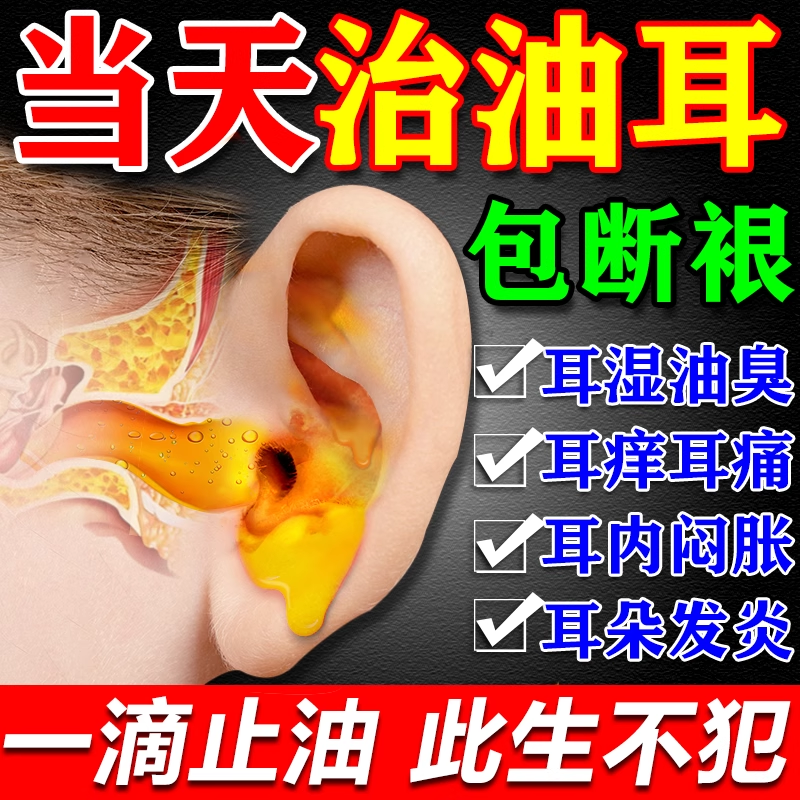 油耳朵清洁器治耳闷耳痒止痒抑菌去油医用耳耵聍清洗器油耳朵克星