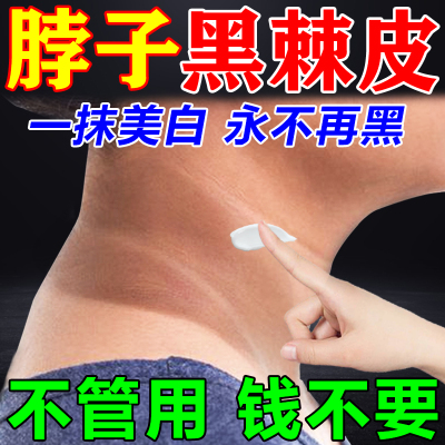 去脖子黑棘皮病药膏去除黑色素沉淀症淡化变白颈部脖子美白霜神器