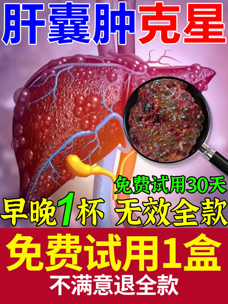 肝囊肿治疗正品的药肝血管瘤消囊去除单多发性肾胆囊息肉中药克星