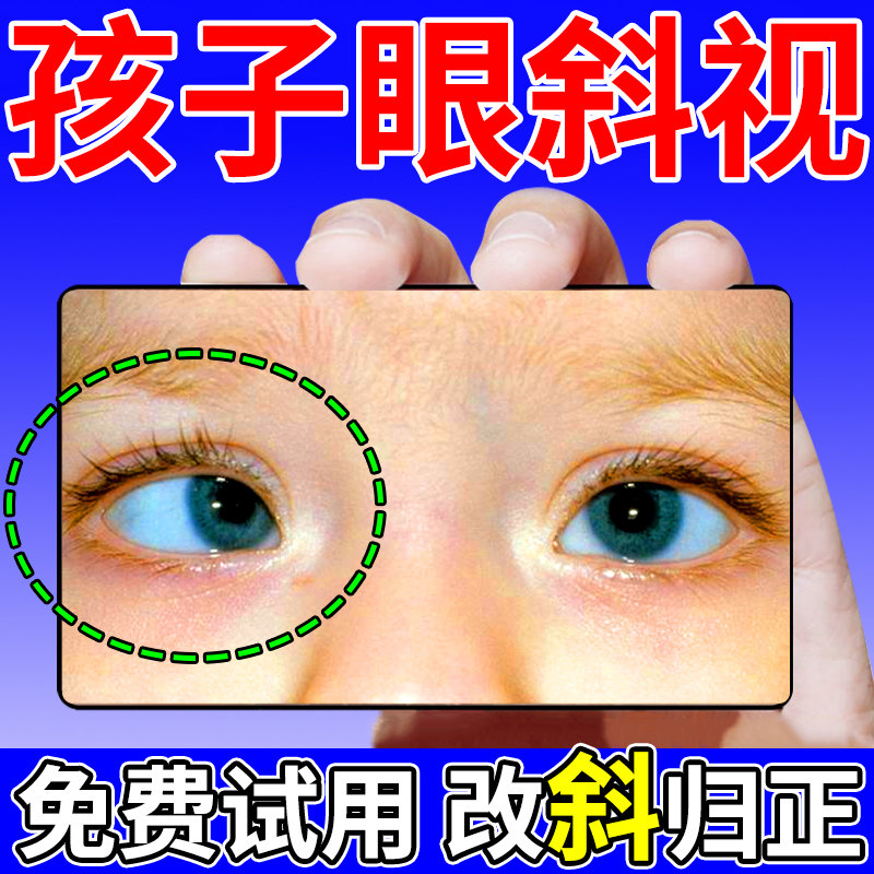 斜视矫正器训练器眼贴聚散球纠正儿童成人眼睛内外弱视斗鸡眼歪斜