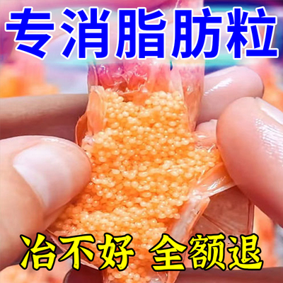 【一抹消除】汗管瘤专用药膏眼部去除神器脂肪粒扁平疣丘疹点汗管