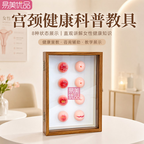 女性宫颈健康8种状态展示模型