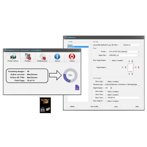 DCMprinter 7.0 DICOM 医学图像虚拟打印机