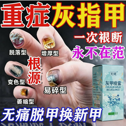 去除灰指甲药水特效专用抑菌亮甲真菌感染脱甲发黄增厚软化一滴净