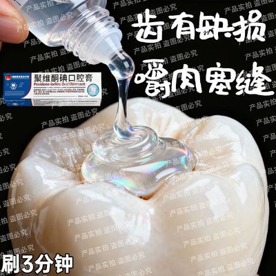 【德国正品】牙齿缺损漏风牙缝大去牙齿晃动牙床萎缩黄美白修复