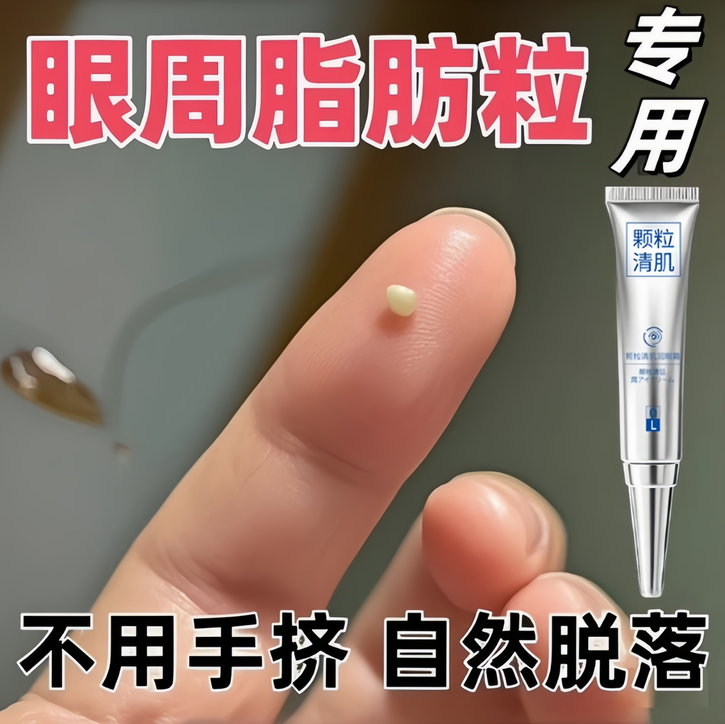 脂肪粒去除神器眼部颗粒眼角眼周油脂粒扁平粒眼霜男女士正品