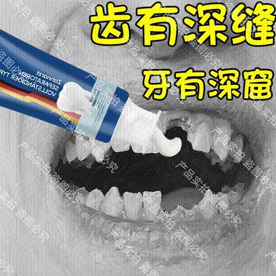 【德国正品】牙齿缺损漏风牙缝大去牙齿晃动牙床萎缩黄美白修复