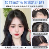 晚晚风胎毛遮盖后脑勺轻薄透全真人发头顶前额头顶补发刘海假发片