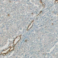 紧密连接蛋白,CLDN polyclonal antibody多克隆抗体WB/IHC/IF/ICC