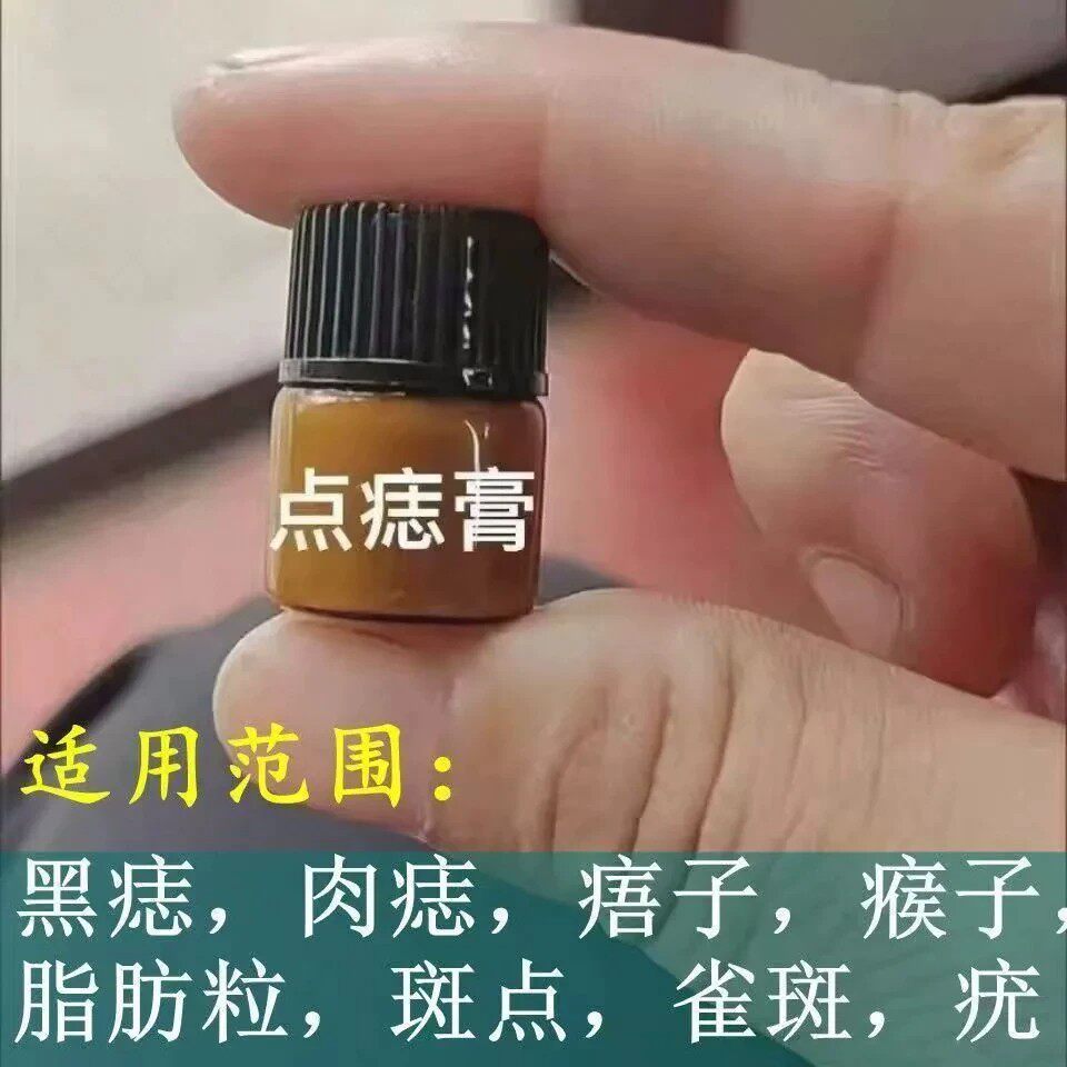 点斑去痣点痣膏脸部专用去痣水志脸部除去黑痣祛取正品药房旗舰店