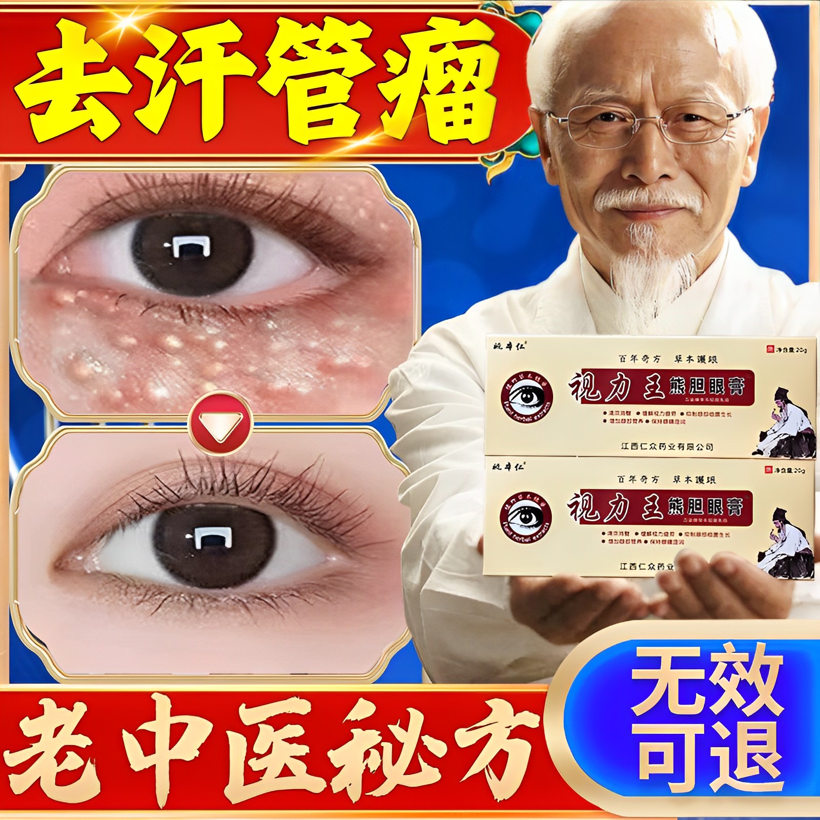 汗管瘤眼部去除神器栗丘疹脂肪粒周围祛油脂粒克星脸上起小疙瘩膏