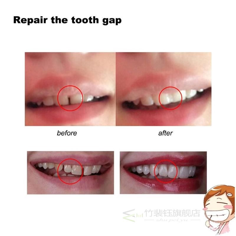 Gap Denture Adhesive Tooth-Repair-Kit Solid-Glue Dental-Rest