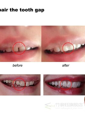 Gap Denture Adhesive Tooth-Repair-Kit Solid-Glue Dental-Rest