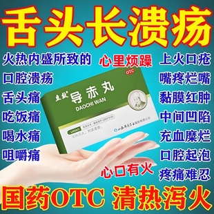 导赤丸散丸散心火口舌生疮药心火旺吃什么药尿黄有异味大便干结sp