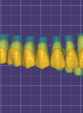 EXO 3shape超多牙形数据库，不变形马龙回切等，