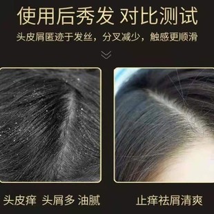 艾草洗發水除螨去屑去頭皮屑止癢洗頭膏精華男女專用店