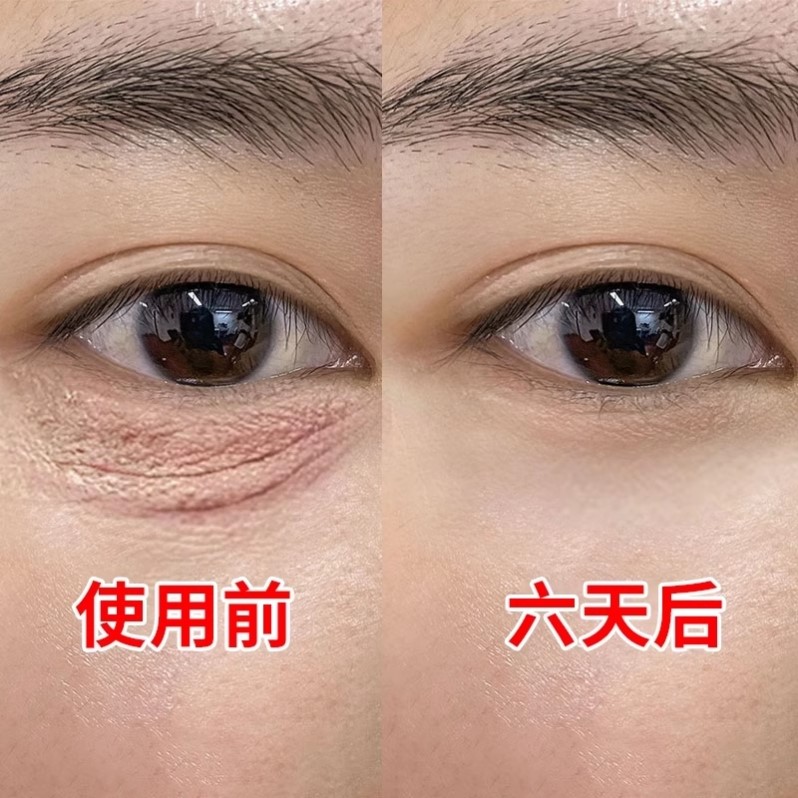 【屈臣氐推荐】再见眼角纹淡化黑眼圈收缩眼袋提拉眼部男女通用