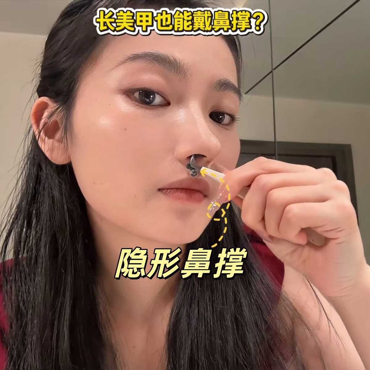 鼻撑挺鼻器缩鼻翼隆鼻固定矫正