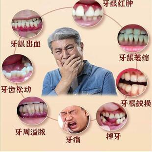 官正品牙齿方松动牙龈肿痛萎缩动PHE固齿晃牙周护理茯苓芦根牛骨