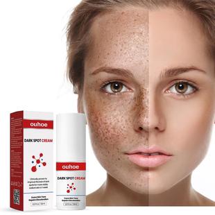 Reduces Whitens That Face Efficiently Melanin Cream Spotted