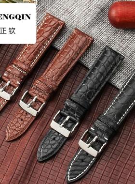 适用真皮表带美洲鳄鱼皮带男代用天王康斯登Rosemont罗西尼女表链