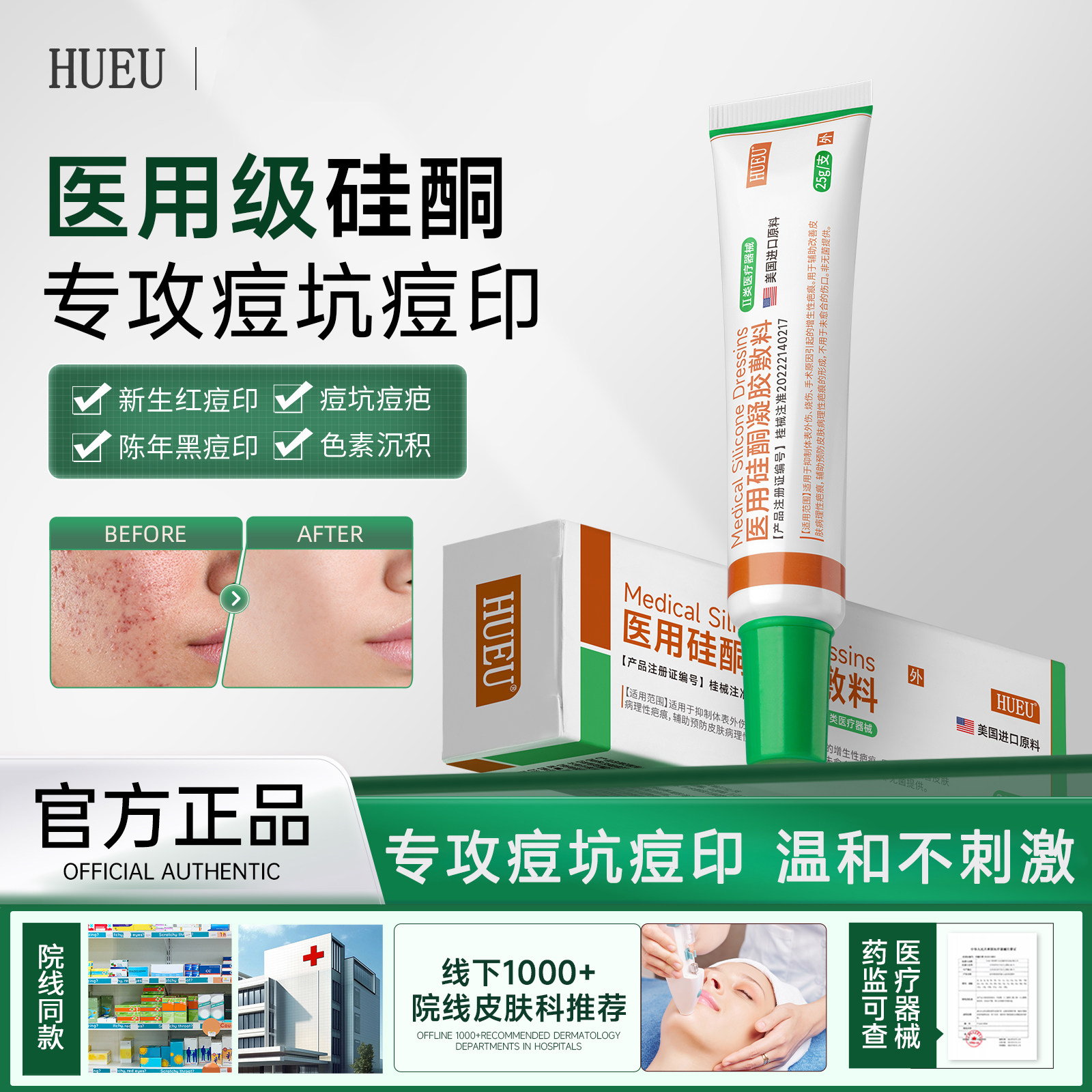 hue硅凝胶hue硅酮凝胶淡化妊娠纹肥胖纹痘印痘坑疤痕医用硅酮