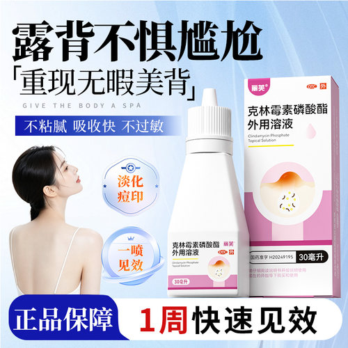 [丽芙]克林霉素磷酸酯外用溶液1%*30ml*1瓶/盒