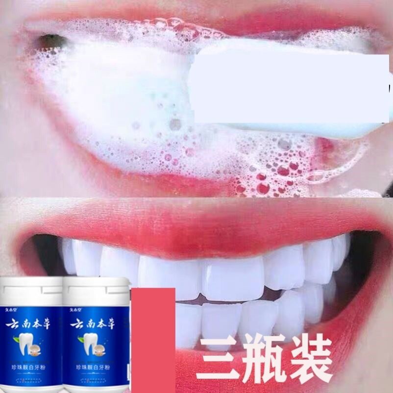 洗牙粉白牙齿去黄洗白速效牙白神器去烟渍牙结石去牙渍污垢非美白